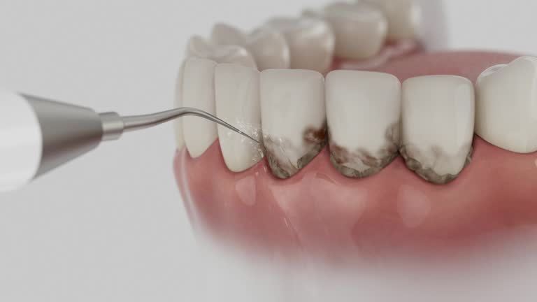 Reliable Teeth Cleaning And Checkup contractor in Bend, OR by Smile Center Dentistry